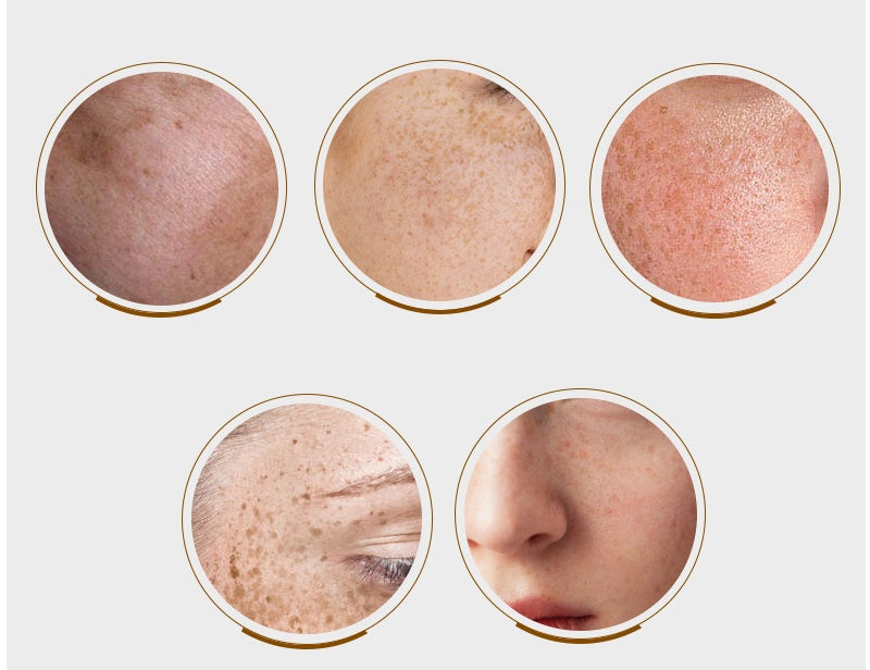 Whitening Cream Spot Pen Spot Lotion