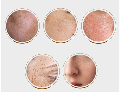 Whitening Cream Spot Pen Spot Lotion